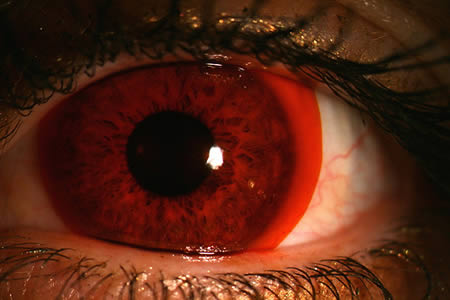 Dari mata turun ke hati